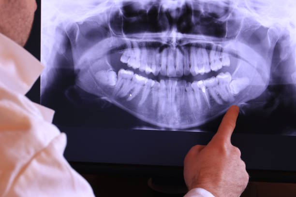 Best Broken or Chipped Tooth Repair in Caddo, OK