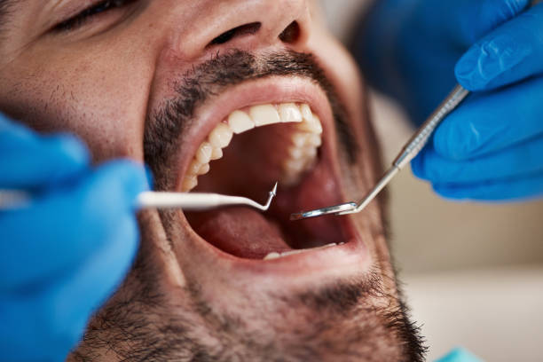 Best Emergency Treatment for Oral Infections in Caddo, OK